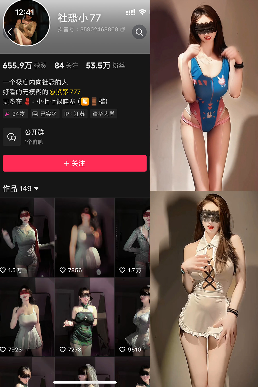 抖音 社恐小77 微密圈 002期 【20V】最新至：2025.3.11-草莓酱