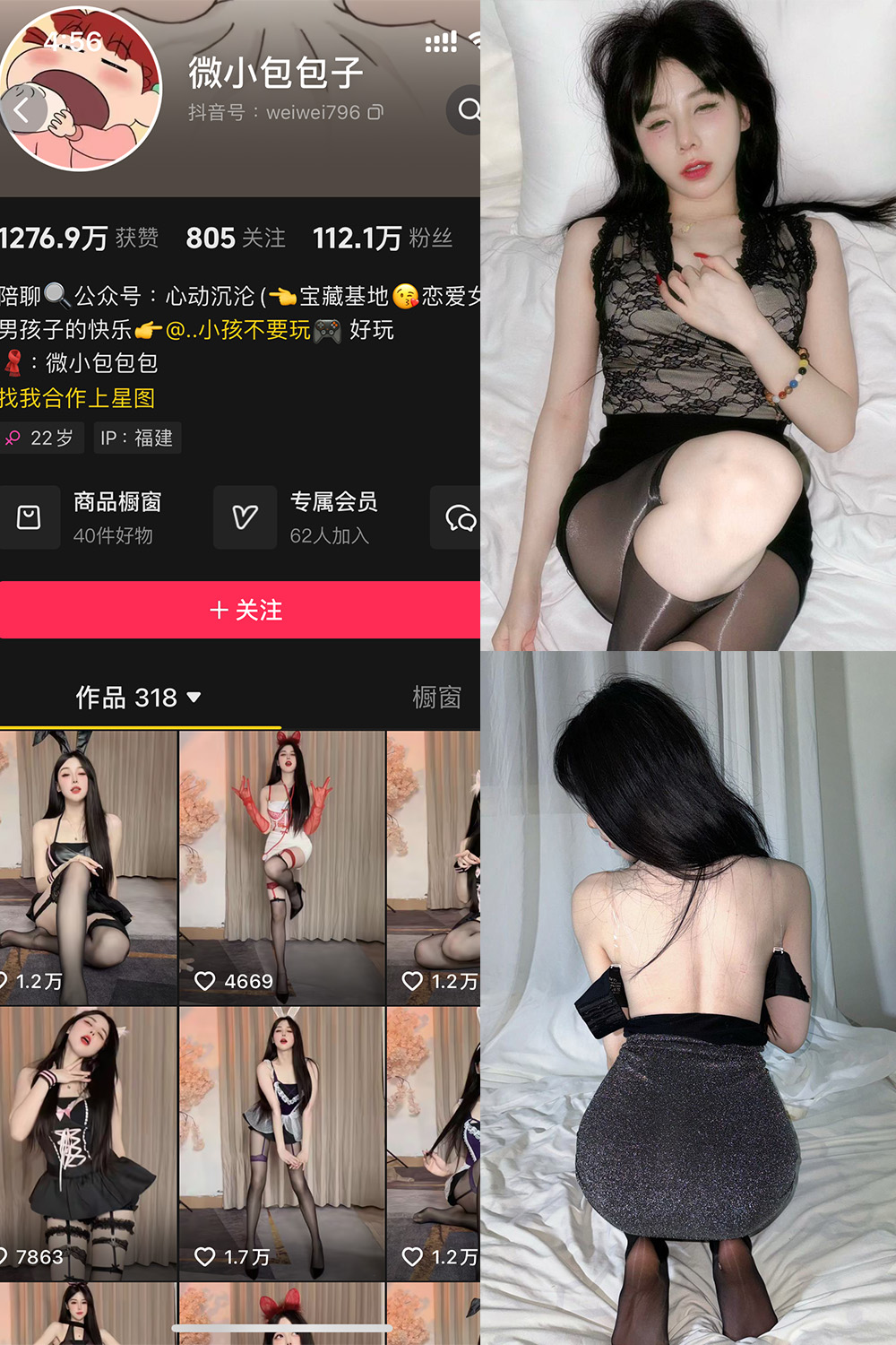 抖音 微小包包子 微密圈  NO.006期 【40P5V】最新至：2024.11.24-草莓酱