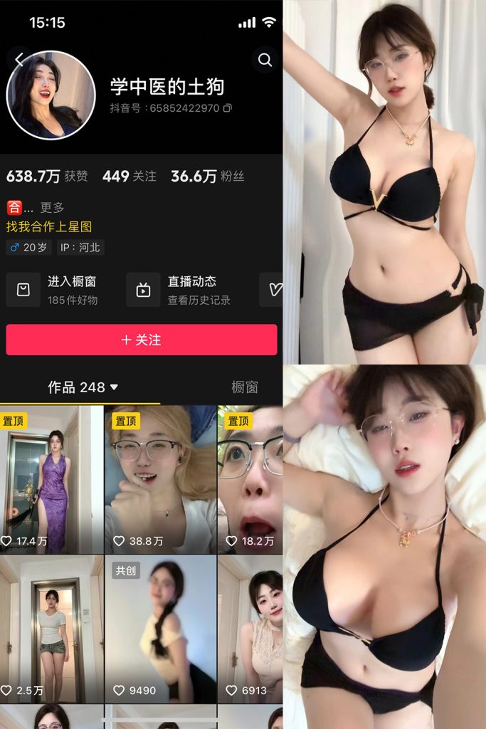 抖音 学中医的土狗 微密圈  NO.002期 【11P1V】最新至：2024.4.18-草莓酱