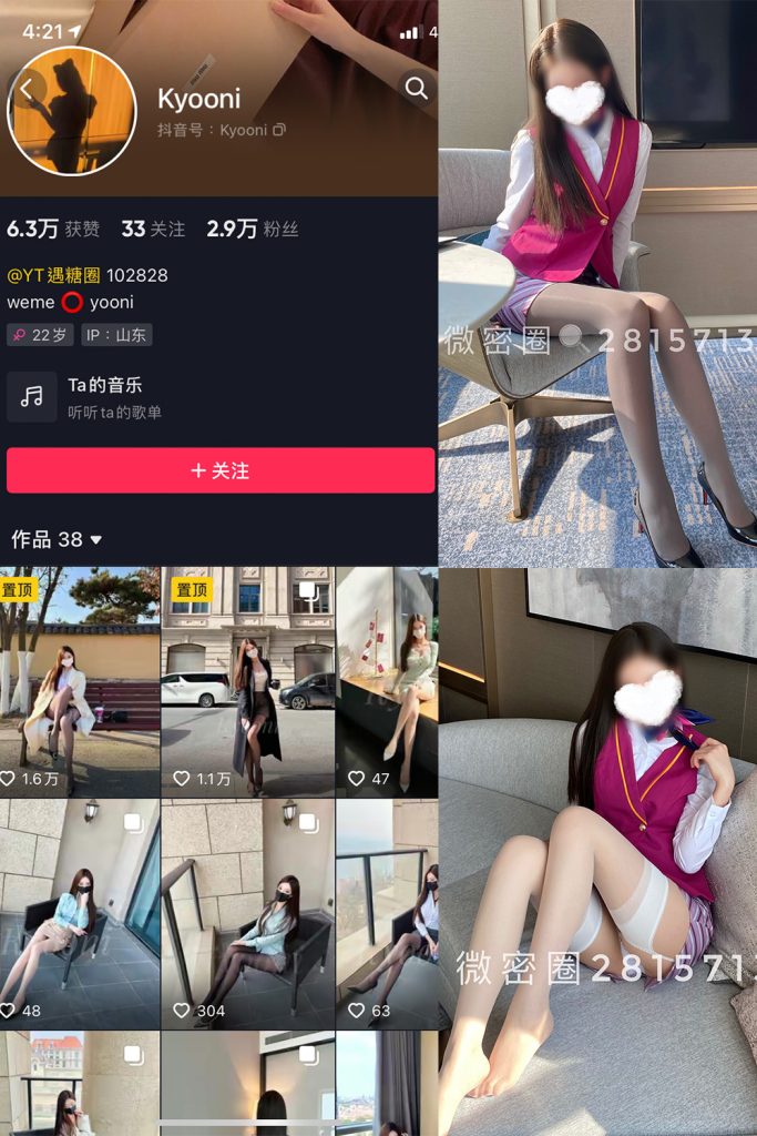 抖音 Yooni有你喵 微密圈  NO.004期 【49P】-草莓酱