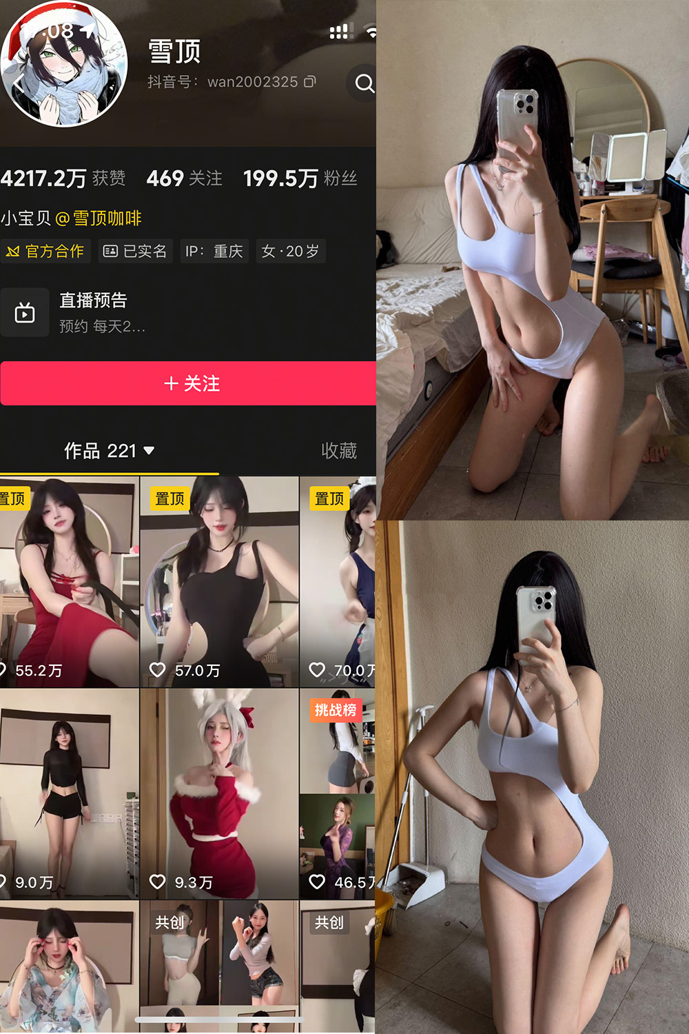 抖音 雪顶 岛遇 NO.014期 【25P】-草莓酱